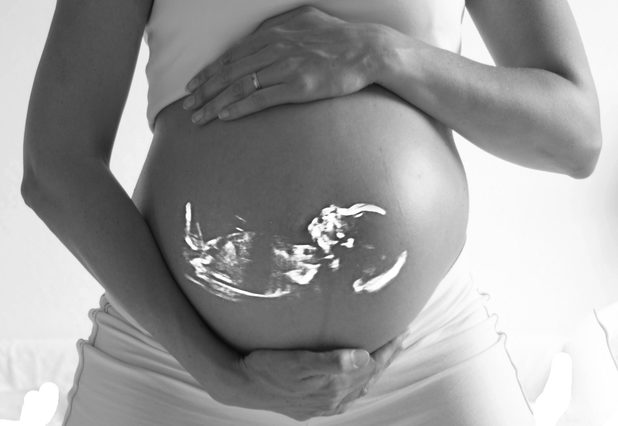 Pregnancy Massage: Considerations and Techniques for Successful Treatments